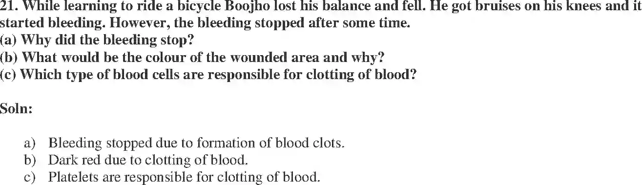 NCERT-Exemplar-Solution-Class-7-Science-Transportation-in-Animals-and-Plants-238-page-8