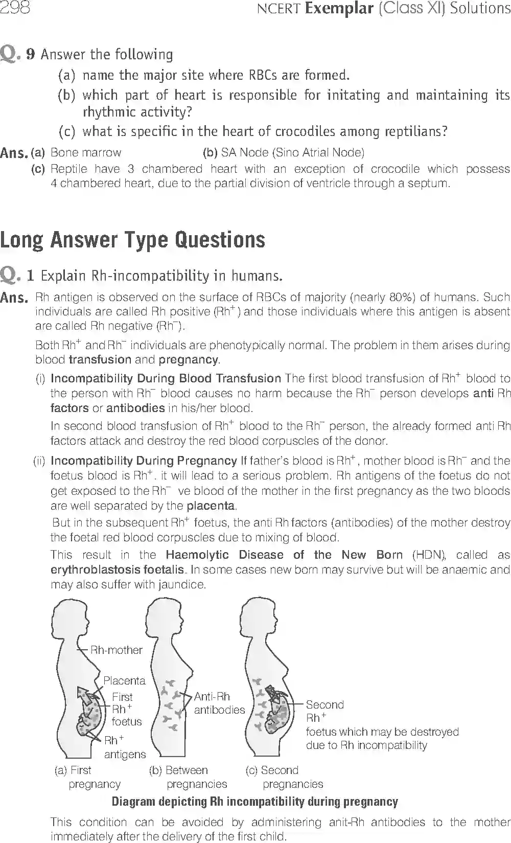 NCERT-Solution-Class-11-Biology-Exemplar-Body-Fluids-And-Circulation-2935-page-15